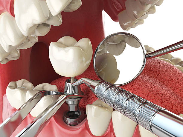 Best Emergency Dental Care for Broken or Chipped Teeth in Mena, AR